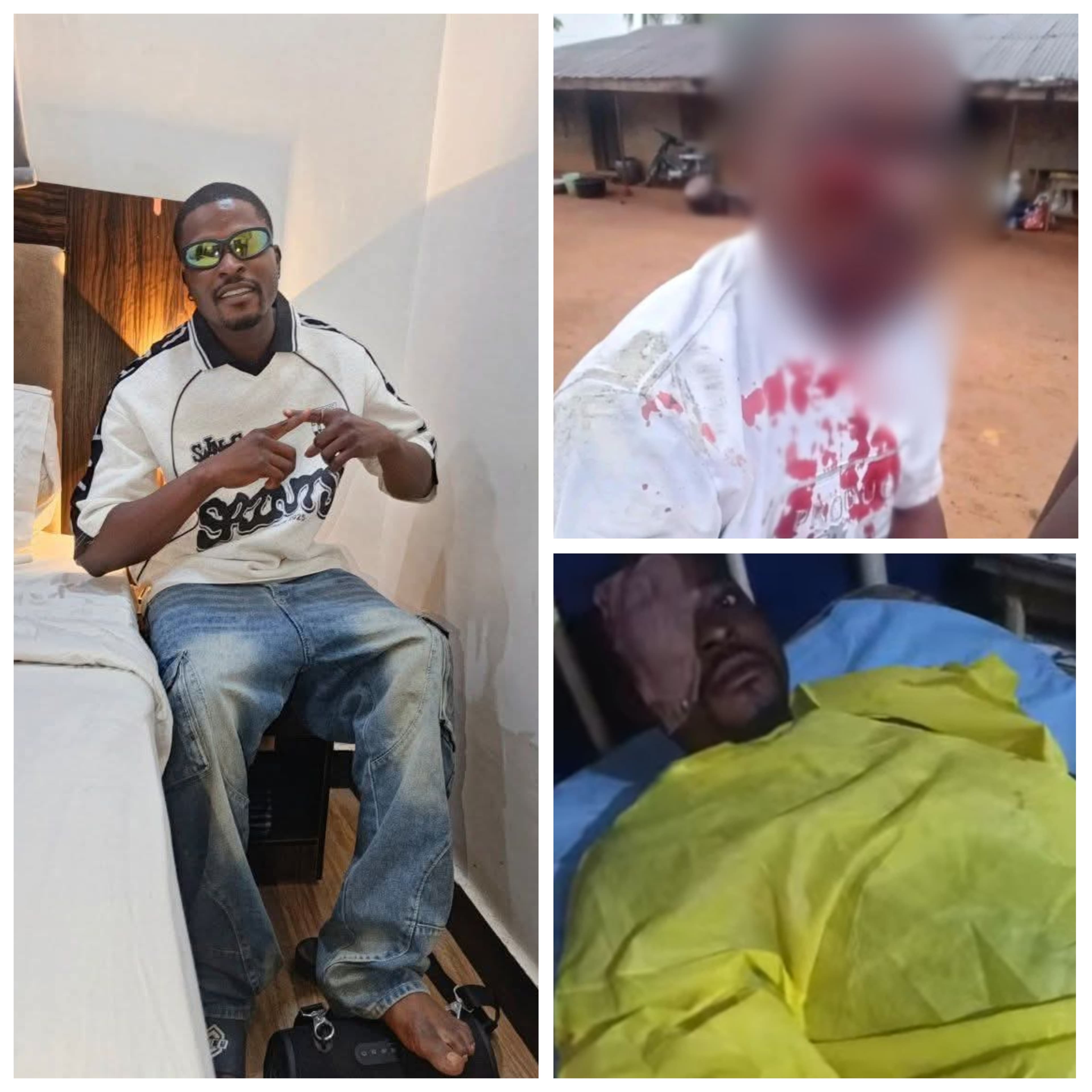 Police officers arrested for allegedly assaulting man and gouging his eye in Ebonyi